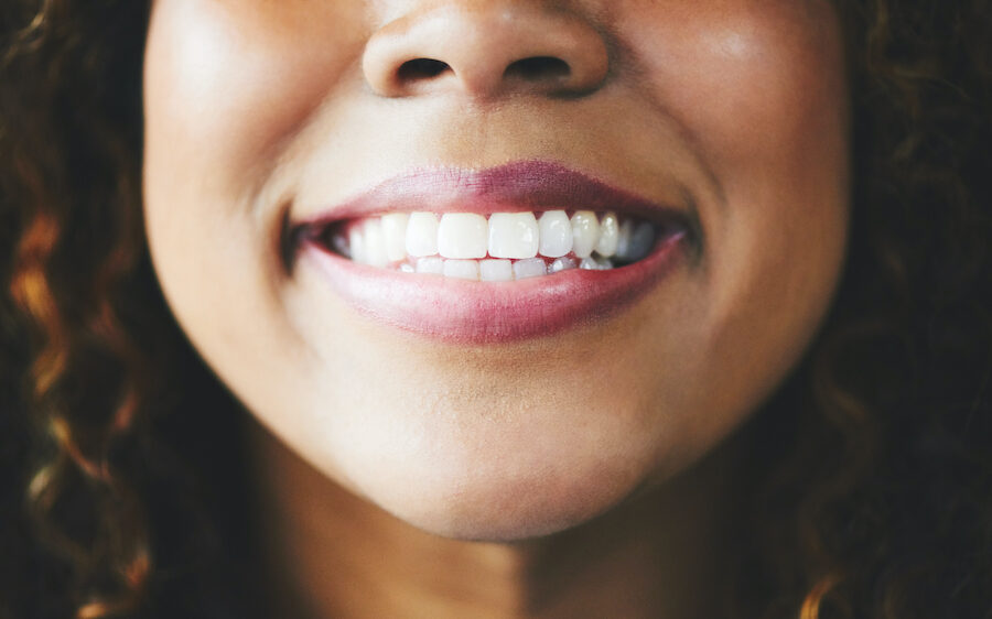closeup of a Black woman smiling after professional teeth whitening in Estero, FL